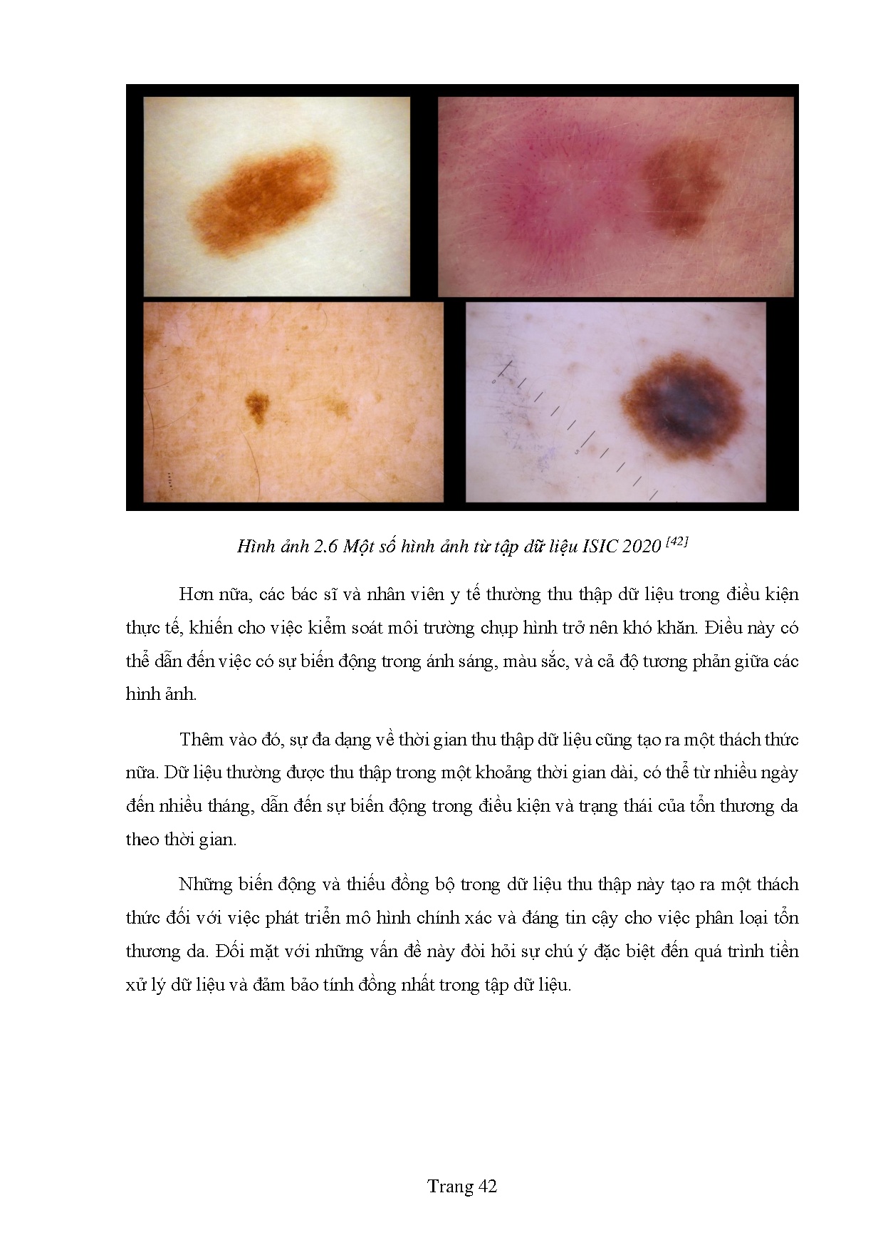 Đồ án tốt nghiệp - Xây dựng mô hình machine learning dự đoán vùng tổn thương trên ảnh y tế - Trang 50