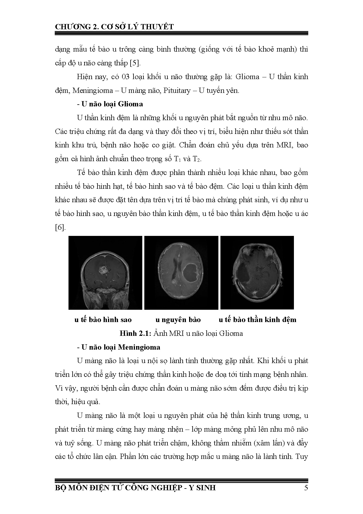 Đồ án tốt nghiệp - Xây dựng thuật toán phân vùng để phân loại và xác định kích thước khối u não - Trang 25