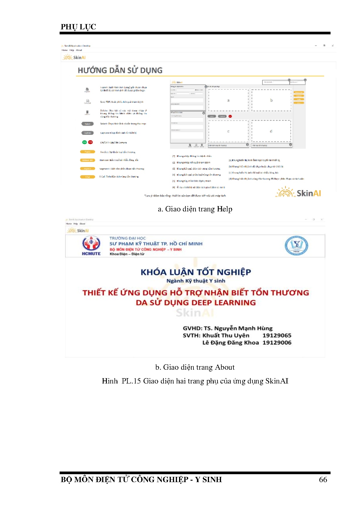 Đồ án tốt nghiệp - Thiết kế ứng dụng hỗ trợ nhận biết tổn thương da sử dụng Deep learning - Trang 81