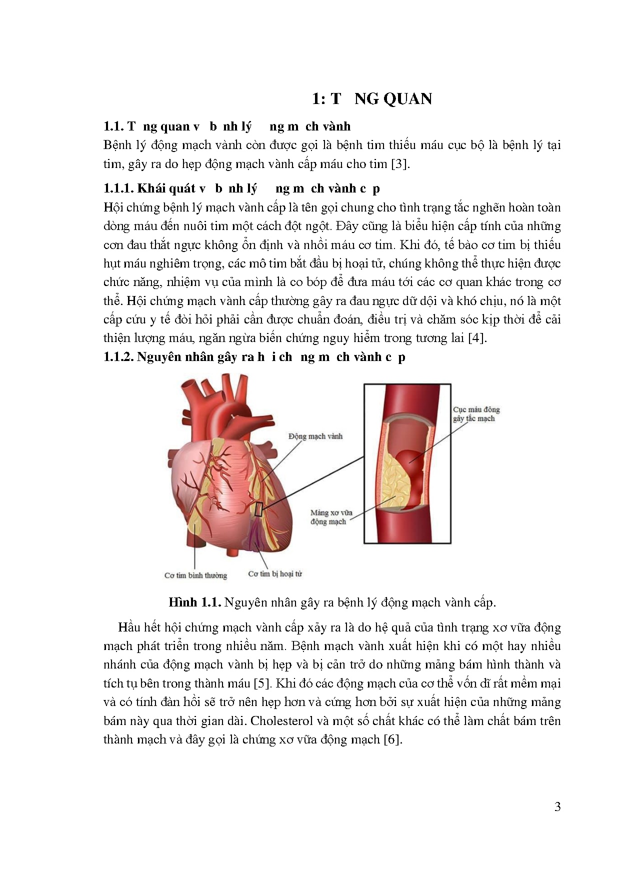 Đồ án tốt nghiệp - Nghiên cứu tính chất điện hóa của lớp Cacbon có cấu trúc kim cương pha TNTBMTKG 3 - Trang 18